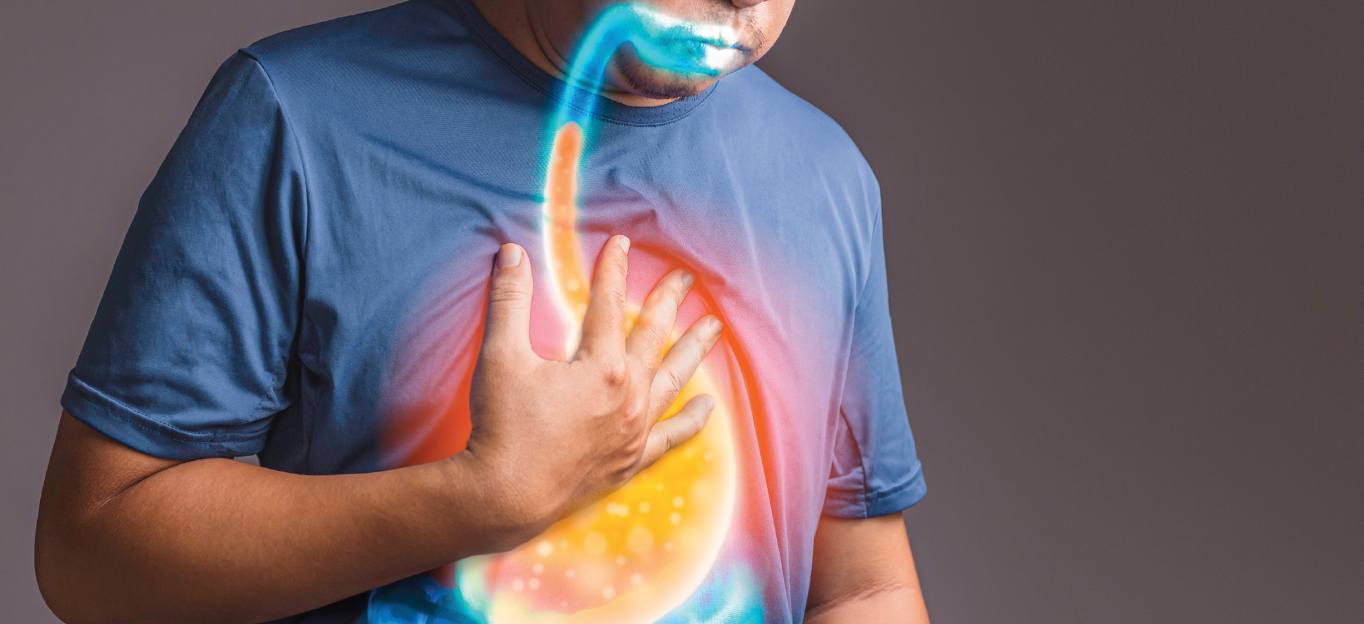 Reflux