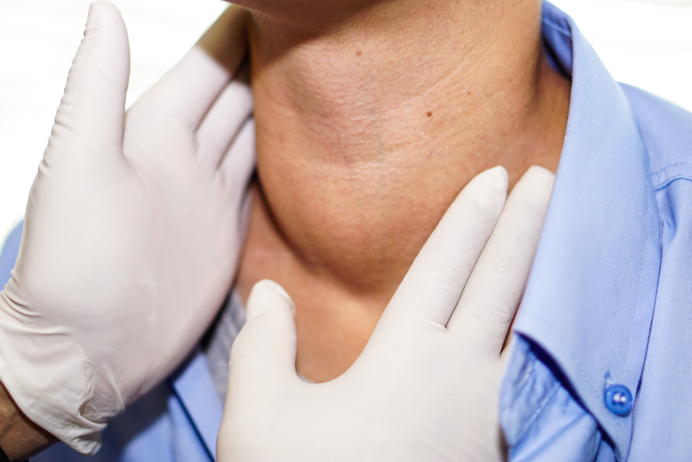 Asian,Lady,Woman,Patient,Have,Abnormal,Enlargement,Of,Thyroid,Gland