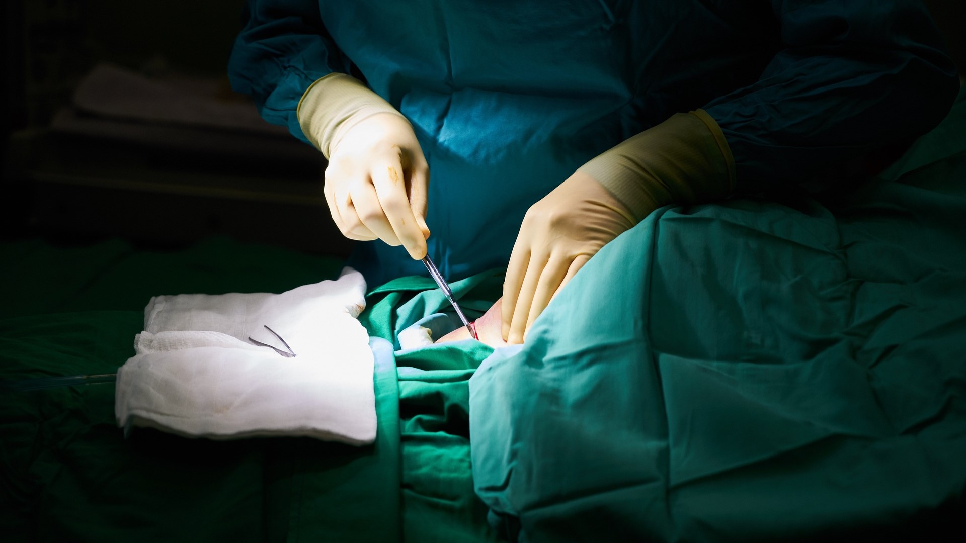 surgery-g827961895_1920