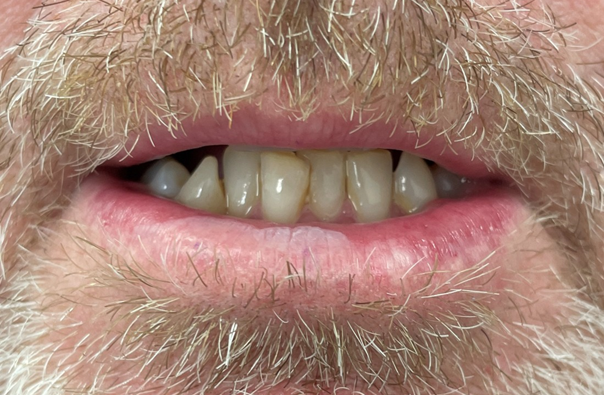 DermScreen-Example