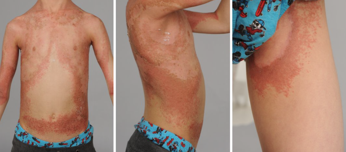 clinical-quick-quiz-red-scaly