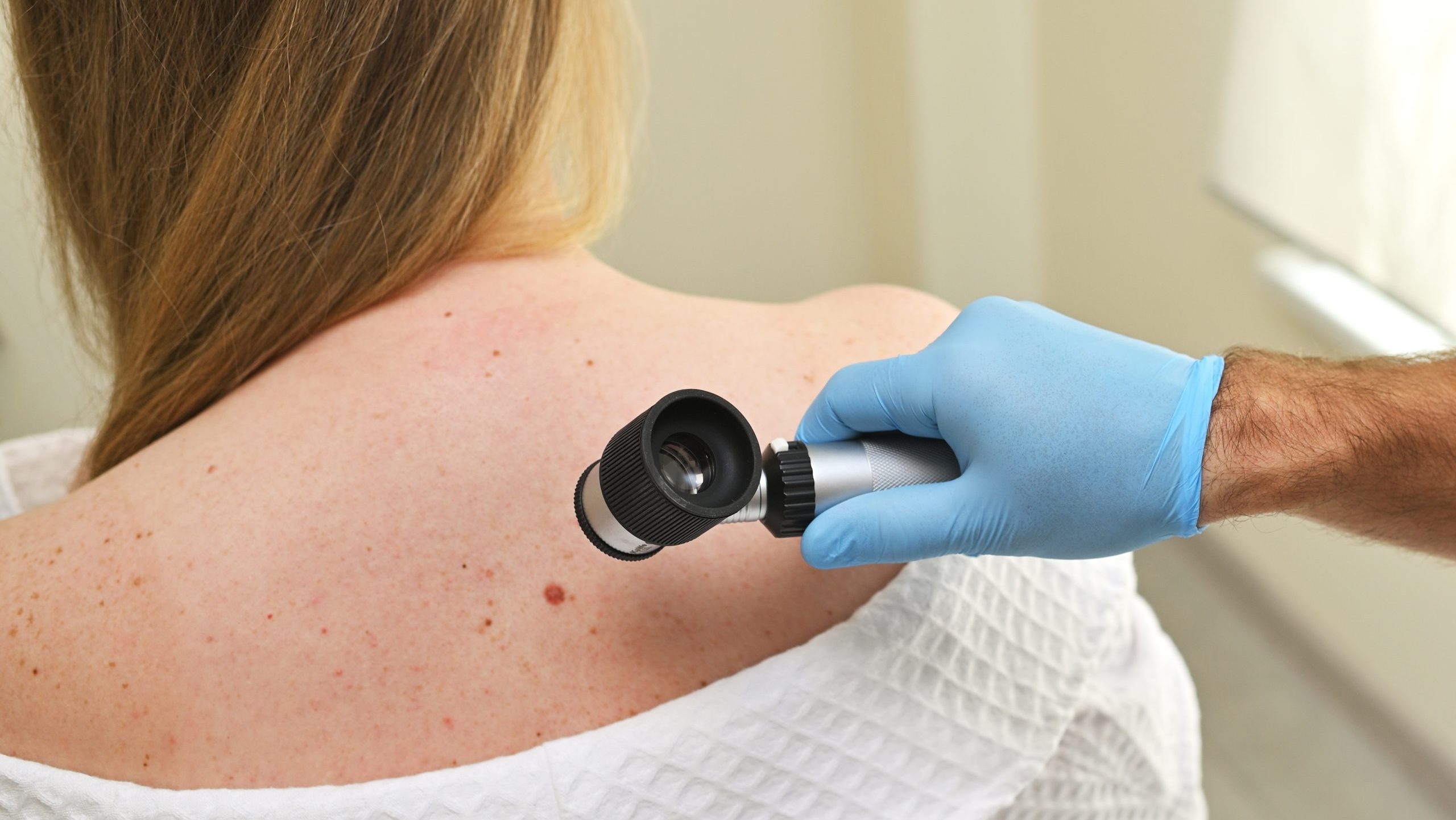 A,Dermatologist,Oncologist,Uses,A,Dermatoscope,To,Examine,Moles,And