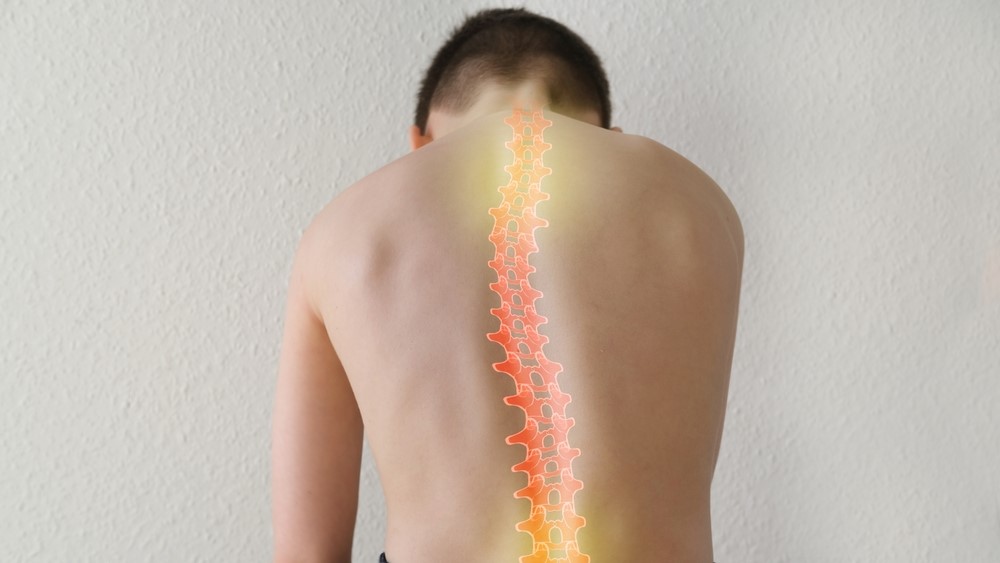 Scoliosis treatments