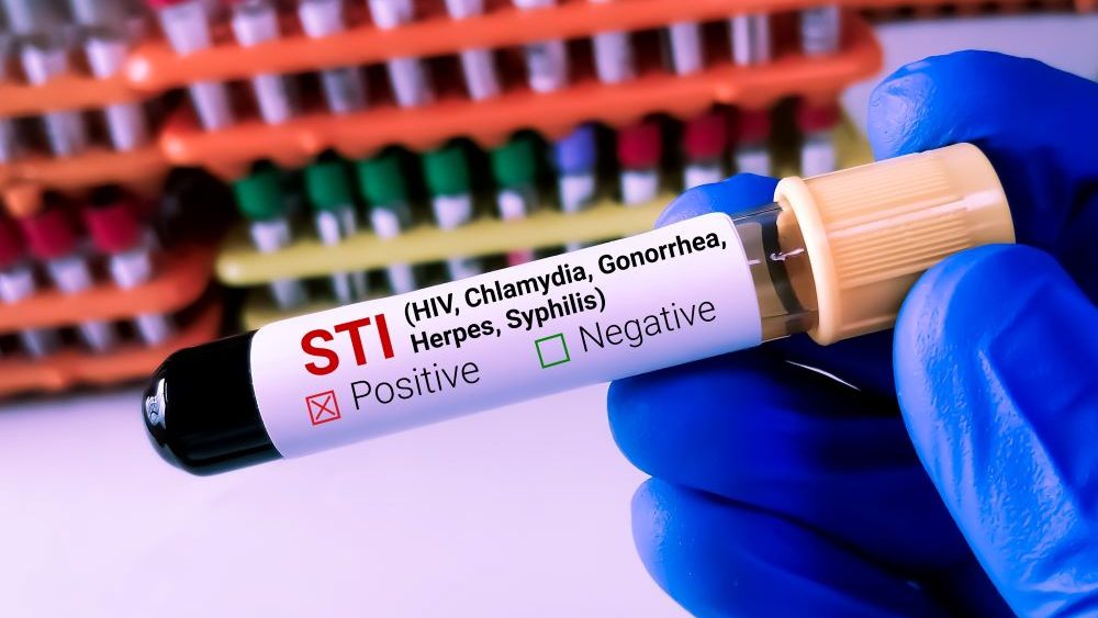 STIs_Hero image