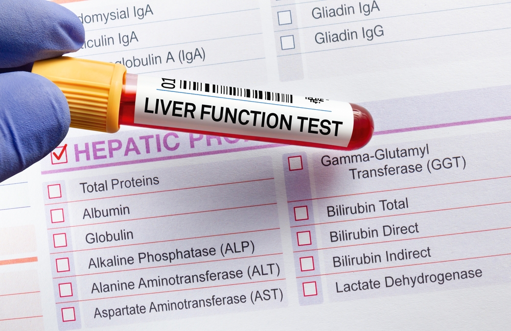 Blood,Sample,Tube,For,Analysis,Of,Lft,Liver,Function,Test.