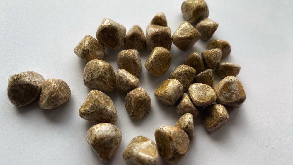 Article Feature Image - Gallstones