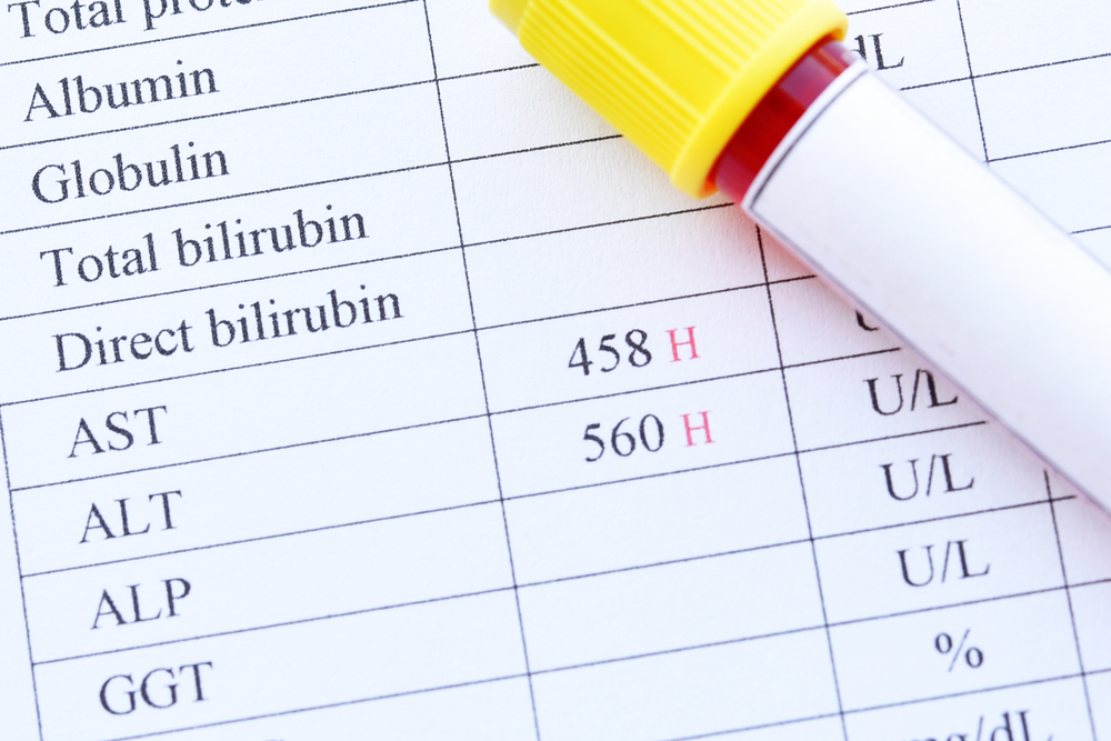 Abnormal,High,Liver,Enzyme,Test,Result,With,Blood,Sample,Tube